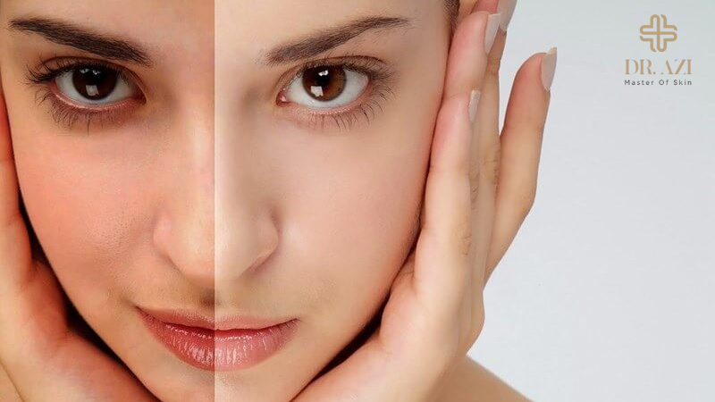 7 Bước Chăm Sóc Da Mặt Tại Nhà Cơ Bản Cho Làn Da Khỏe