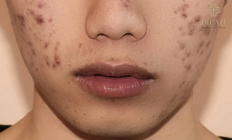 7 bước chăm sóc da mặt