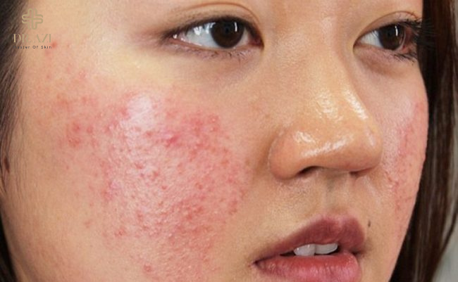 7 bước chăm sóc da mặt