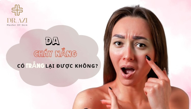 Da bị cháy nắng có trắng lại được không? Cách phục hồi